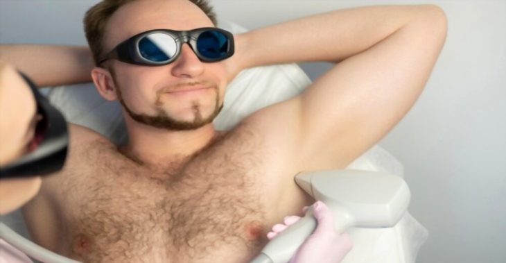 ¿Cuánto cuesta la depilación láser en hombres?