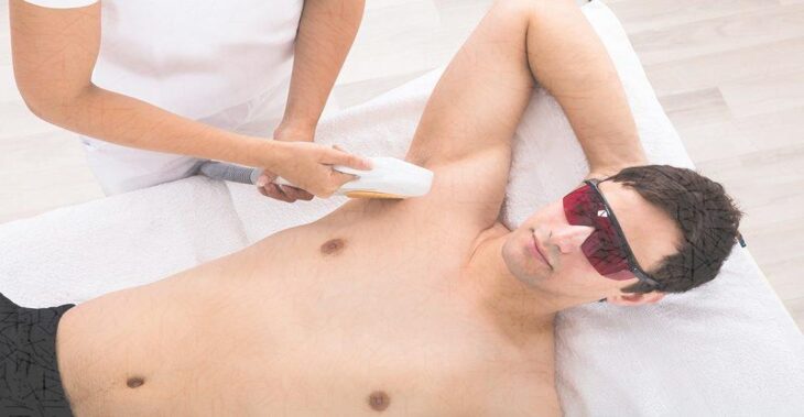 8 things that get you hooked on male laser hair removal