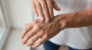 La salud de tus manos importa mucho más de lo que tú crees