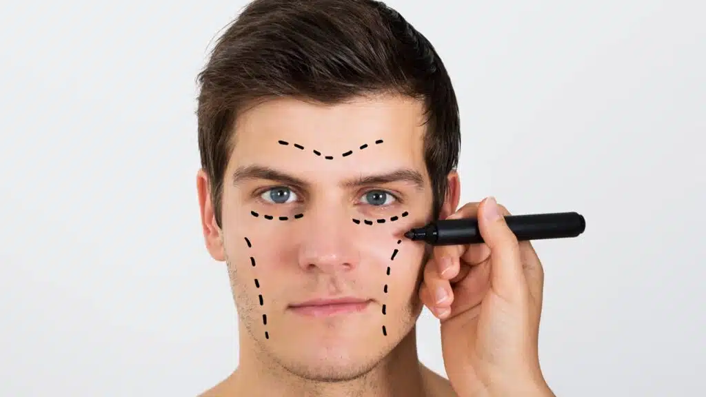 Cirugía cosmética para hombres