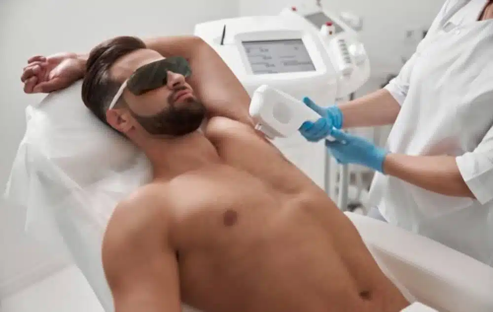 depilacion laser completa hombre barcelona