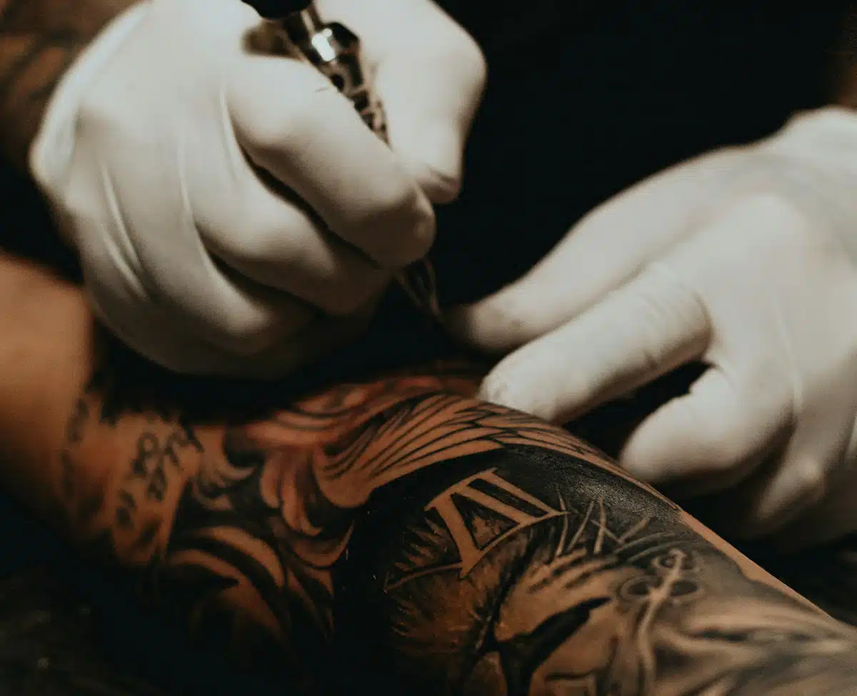 eliminacion de tatuajes Barcelona