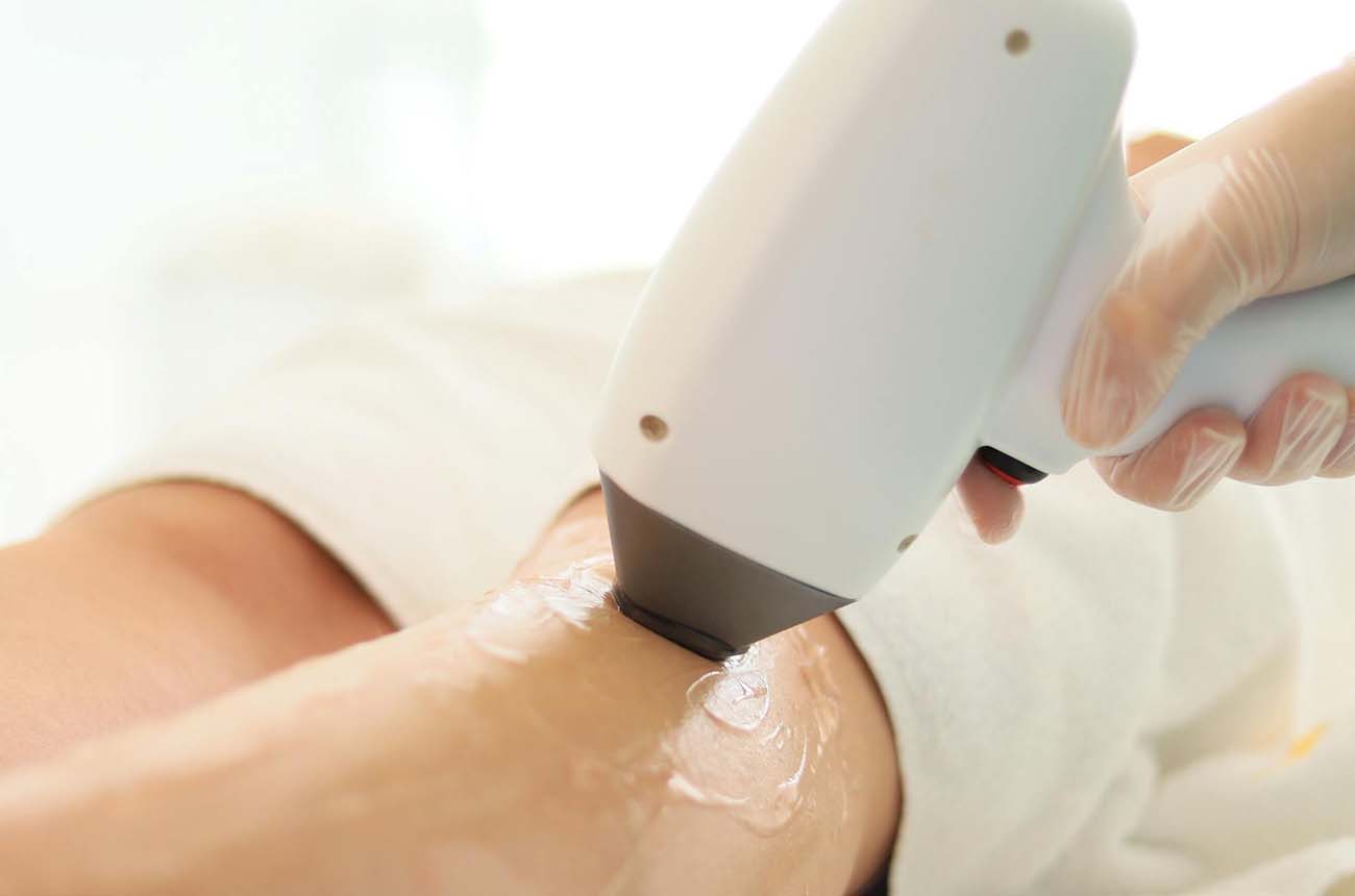 donde hacer depilación laser masculina