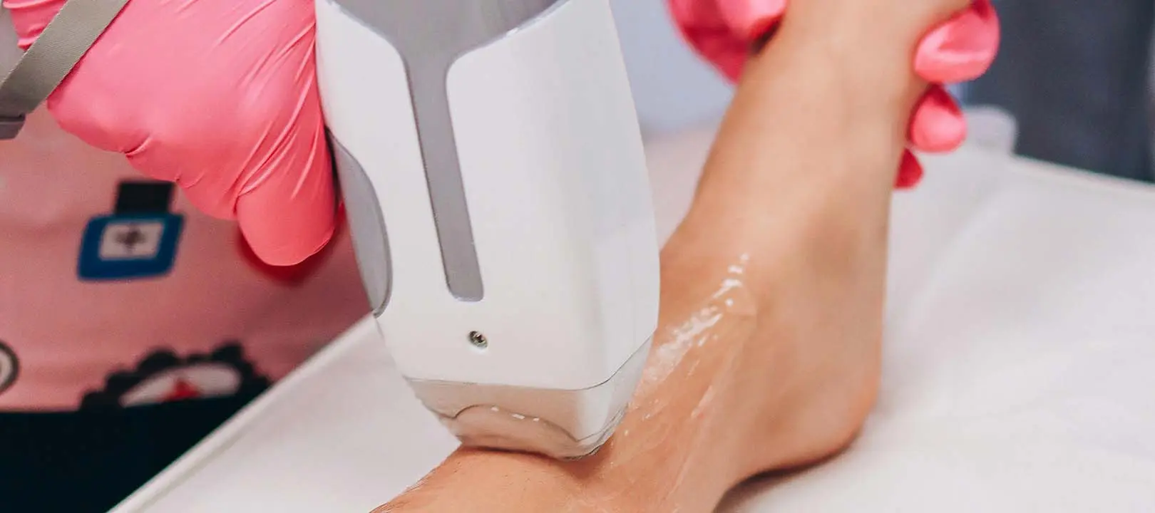 depilacion laser piernas hombre