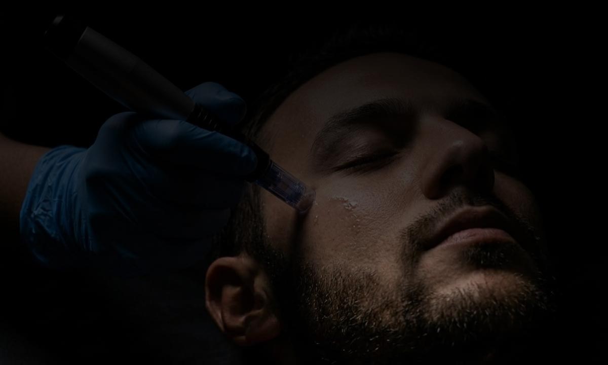 faciales masculinos barcelona